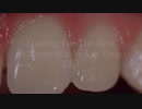 Dr. Melanie Orthodontics San Diego CA | (858) 613-3688