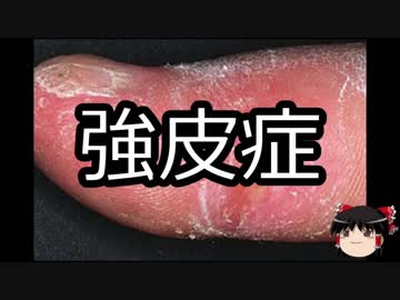 【ゆっくり朗読】ゆっくりさんと不思議な病気 その16