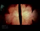 実況　BIO HAZARD2 part12(end)
