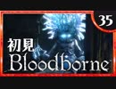 卍【実況】今日のブラッドボーン_35