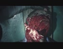 [海外版・グロ注意]　顔が抉れた死体　バイオハザードRE2　RESIDENT EVIL 2
