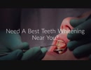 Florida Dental Care of Miller : Teeth Whitening Near You