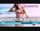 Queens Liposuction Surgeon for Laser Liposuction Surgery in NYC