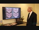 Facial Aging in Women - Facial Fillers Lexington Kentucky