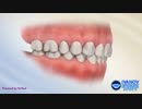 Top Invisalign Orthodontist Near Me