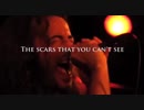 Secret Sphere-The scars that you can’t see