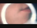 ズームアップ毛抜き Dr.tweezers Remove hair microscope 毛抜先生 닥터 족집게