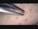 014 素早く引き抜く  高倍率毛抜き Dr.tweezers Remove hair microscope 毛抜先生 닥터 족집게