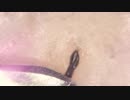 016 角栓のような毛根？  高倍率毛抜き Dr.tweezers Remove hair microscope 毛抜先生 닥터 족집게