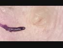017 限界倍率で抜いてみる  高倍率毛抜き Dr.tweezers Remove hair microscope 毛抜先生 닥터 족집게