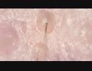 019　限界倍率で産毛抜き　 高倍率毛抜き Dr.tweezers Remove hair microscope 毛抜先生 닥터 족집게