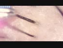 033 毛根鞘超拡大 Dr. tweezers 高倍率毛抜き Pull out