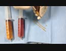 【脂肪吸引の失敗修正】治療に用いるコンデンスリッチファットとは？｜THE CLINIC