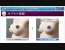 【豊胸で失敗】シリコンバッグ豊胸の失敗修正