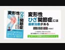 「変形性ひざ関節症には最新治療がある」電子書籍サンプル版を無料プレゼント！