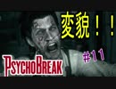 【サイコブレイク　キッド編　初見実況】死が渦巻く狂気の世界からの脱出！　Part 11