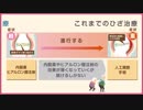 変形性膝関節症の治療に「再生医療」という選択肢があるのをご存知でしょうか？『よくわかる ひざ再生医療』今すぐ無料でダウンロード