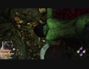 【dbd】ハグばかりやってる人間が電気治療はじめましたpart12