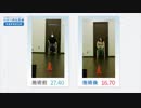 ひざの再生医療により、杖がなくても歩けるようになった歩行症例【培養幹細胞治療】