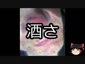 【ゆっくり朗読】ゆっくりさんと不思議な病気 その75