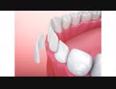America Dental Clinic: Dental Implants Near You