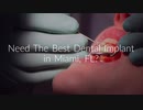 Dental Implants Treatment : Right Care Dental in Miami, FL