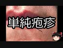 【ゆっくり朗読】ゆっくりさんと不思議な病気 その121