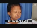 体重21キロ！ 中国で極貧の女子大生が死亡・寄付金100万元の行方は？