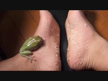 カエルと足裏の皮を剥がすホモ