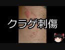 【ゆっくり朗読】ゆっくりさんと不思議な病気 その147