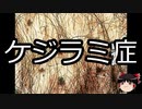 【ゆっくり朗読】ゆっくりさんと不思議な病気 その151