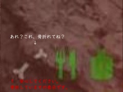 【Rising World】水奈瀬コウの「骨折から始まるサバイバル」Part1
