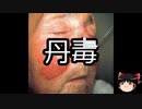【ゆっくり朗読】ゆっくりさんと不思議な病気 その158