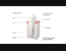 Trinity Dental Arts : Best Dental Implants