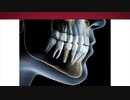 Salvatore Dental : Best Dental Implants