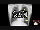 【ゆっくり朗読】ゆっくりさんと不思議な病気 その173