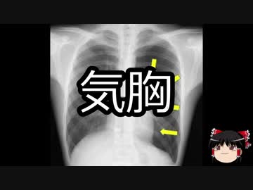 【ゆっくり朗読】ゆっくりさんと不思議な病気 その173