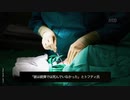 同意無し麻酔無しでも臓器提供