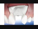 North River Dental : Best Dental Implants
