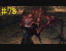 【Bloodborne】フロムゲー初心者のブラッドボーンpart78【実況プレイ】