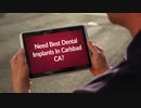 Carlsbad Dental Care : Best Dental Implants