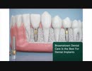 Brownstown Dental Care : Best Dental Implants