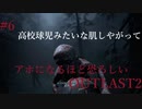アホになるほど恐ろしい【OUT LAST2】#6