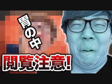 【閲覧推奨】ヒワイキンの胃の中お見せします【胃カメラデビュー】