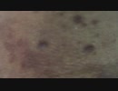 202005121836