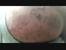 202005141026