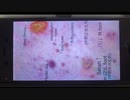 202003250000■昔から「病気は民族性に顕著」と言いますがtoo much grotesque African/Asian-Japanese Televisions/Showbiz