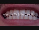 Smile Glen Ellyn : Dental Implants in Carol Stream IL