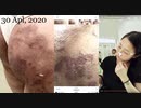 202004300844■After the Nagoya/Funabashi/Gyotoku Arson in 18 Dec, 2015