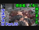THE LAST OF US PARTⅡ 実況プレイ #35 感染者、上手に焼けました